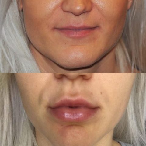 HUULTEN MUOTOILU (+ ALEKOODI!)